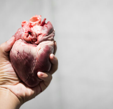 Pig heart used in animal trasplant experiments