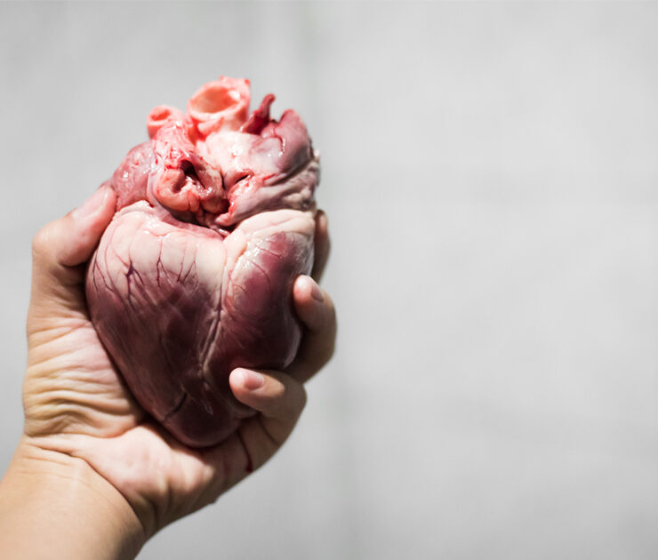 Pig heart used in animal trasplant experiments